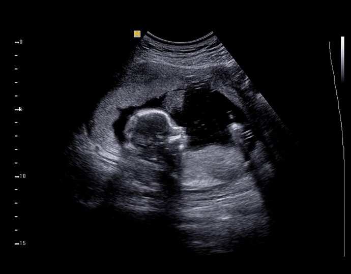 ultrasound-baby-327047425